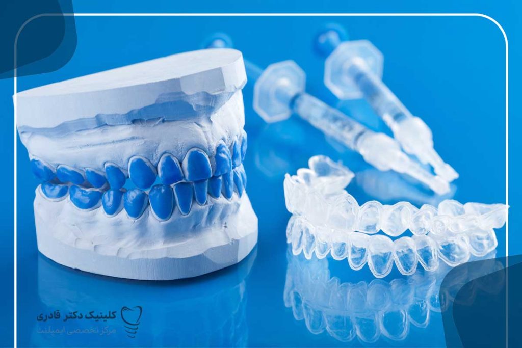 روش‌های بلیچینگ دندان چیست؟