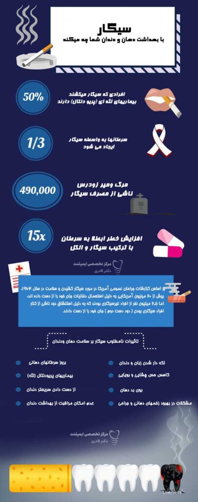 تاثیر سیگار بر ایمپلنت (Infographic)