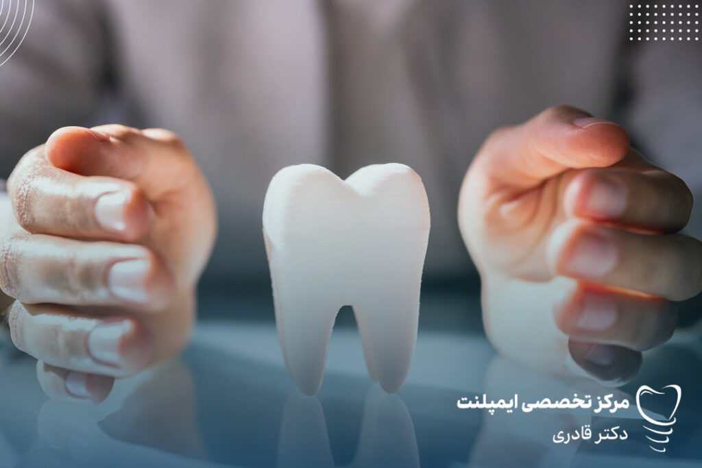 ایمپلنت دندان با بیمه