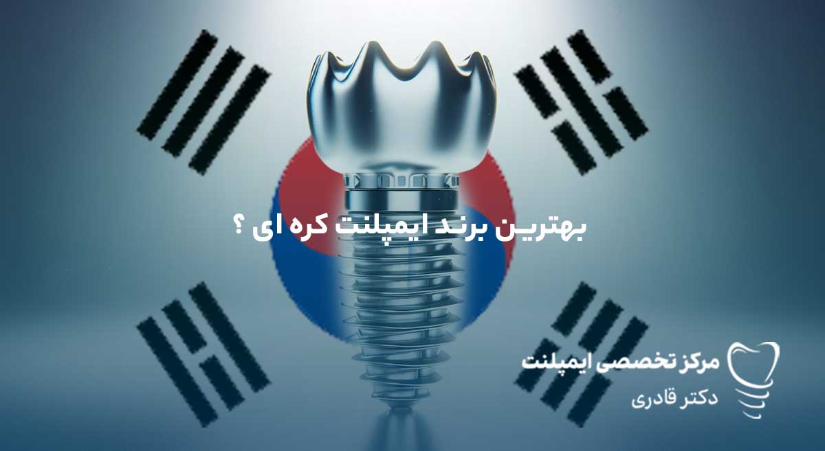 بهترین برند ایمپلنت کره ای بهترین مارک