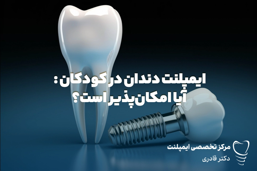 ایمپلنت دندان در کودکان