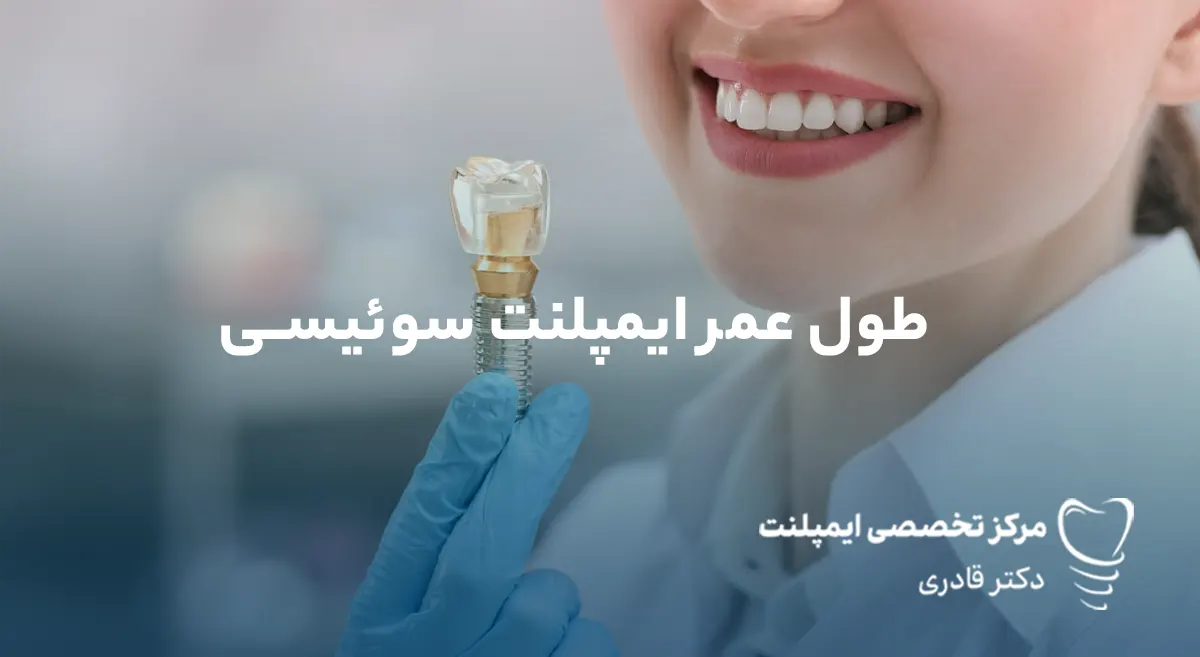 طول عمر ایمپلنت سوئیسی