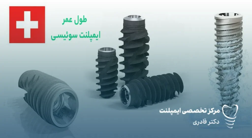 مدت عمر ایمپلنت سوئیسی