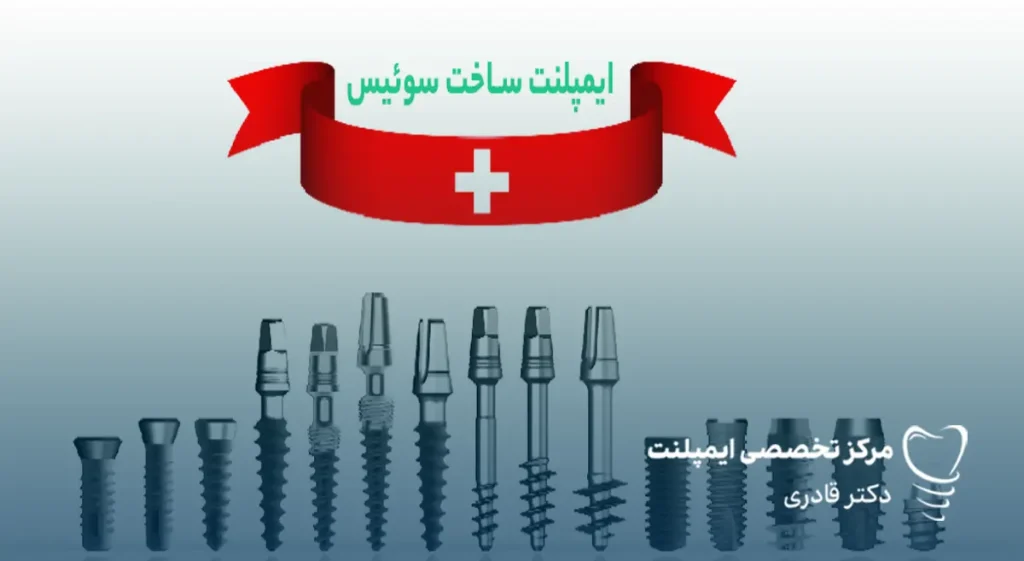 چند نوع ایمپلنت سوئیسی