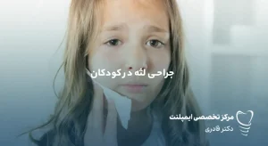 مقالات 38 جراحی لثه در کودکان