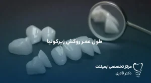 طول عمر روکش زیرکونیا