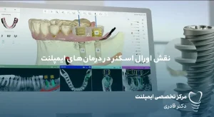 اورال اسکنر در درمان‌های ایمپلنت
