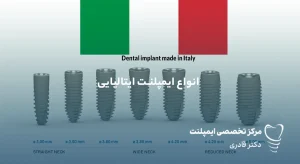 ایمپلنت ایتالیایی