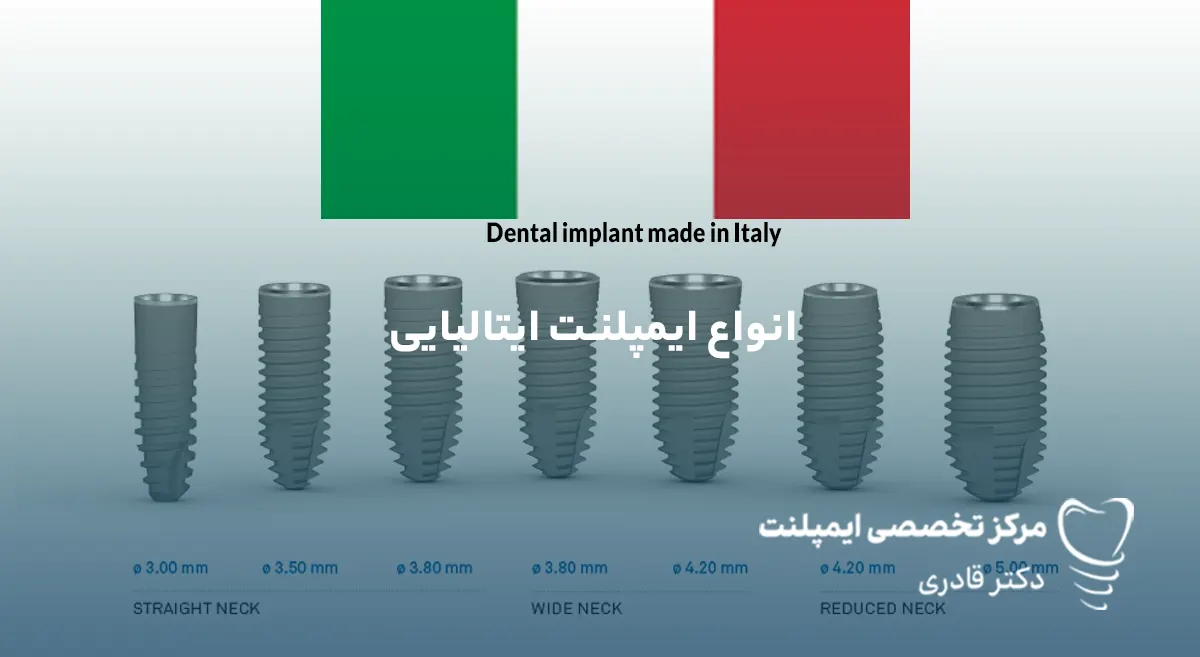 ایمپلنت ایتالیایی