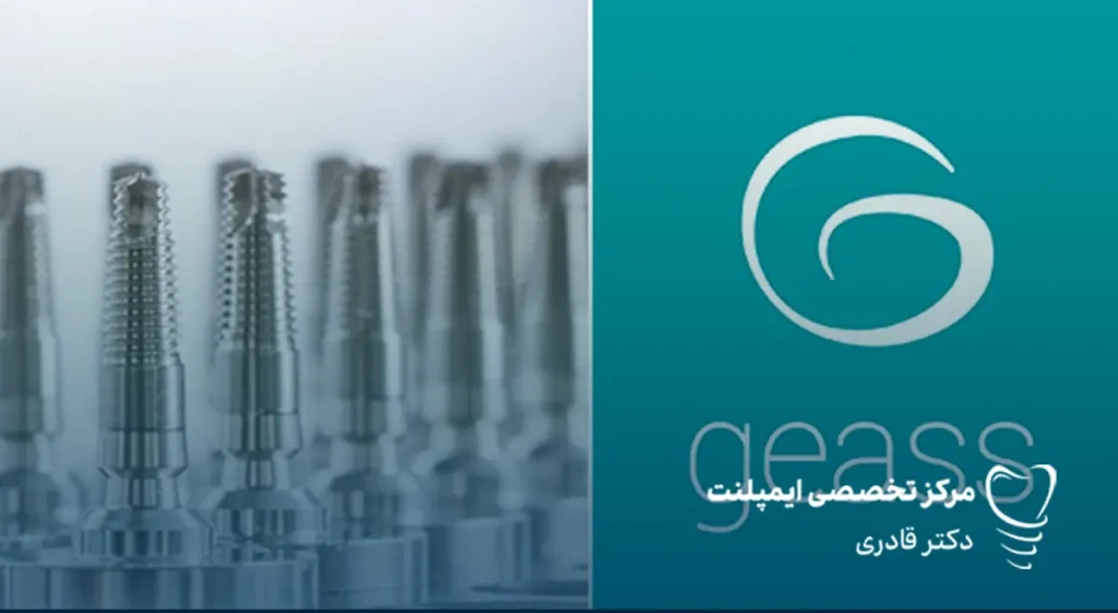 ایمپلنت ایتالیایی