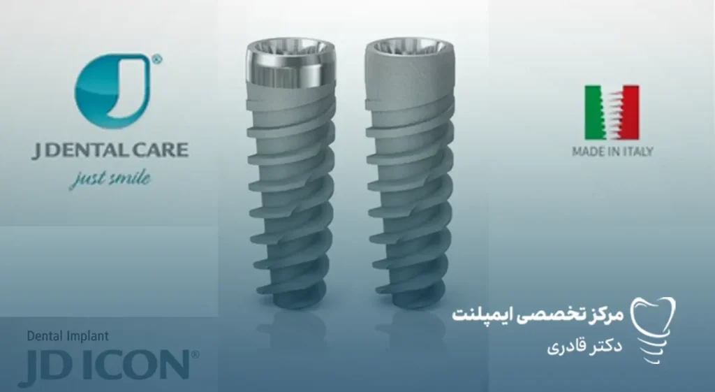 ایمپلنت ایتالیایی