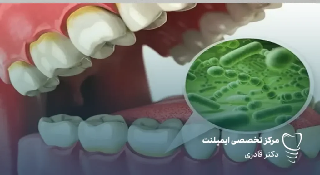 طعم اهن در دهان دلیل