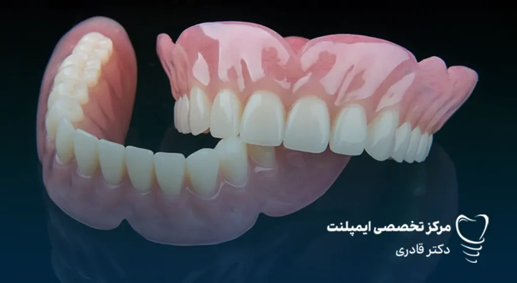 پروتز دندان یا ایمپلنت