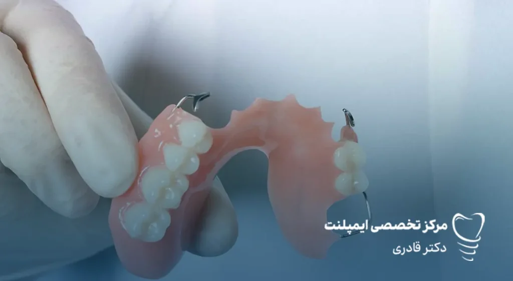 انواع دندان مصنوعی