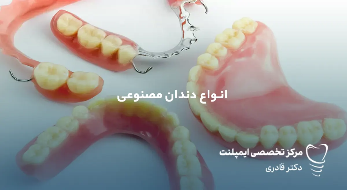 انواع دندان مصنوعی