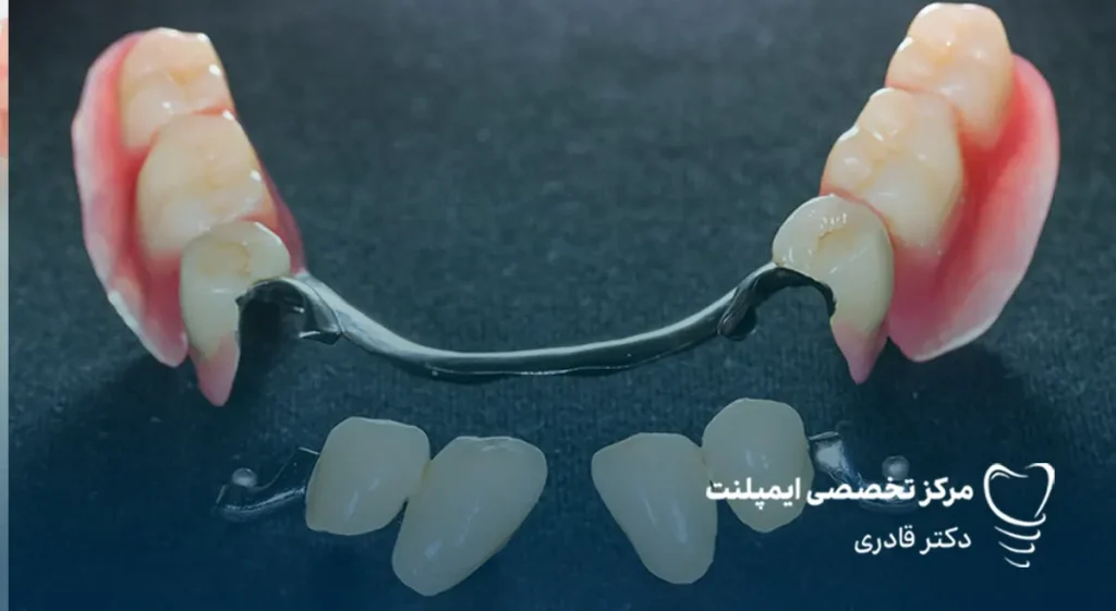 انواع دندان مصنوعی