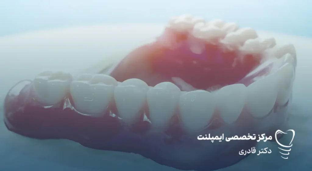 انواع دندان مصنوعی