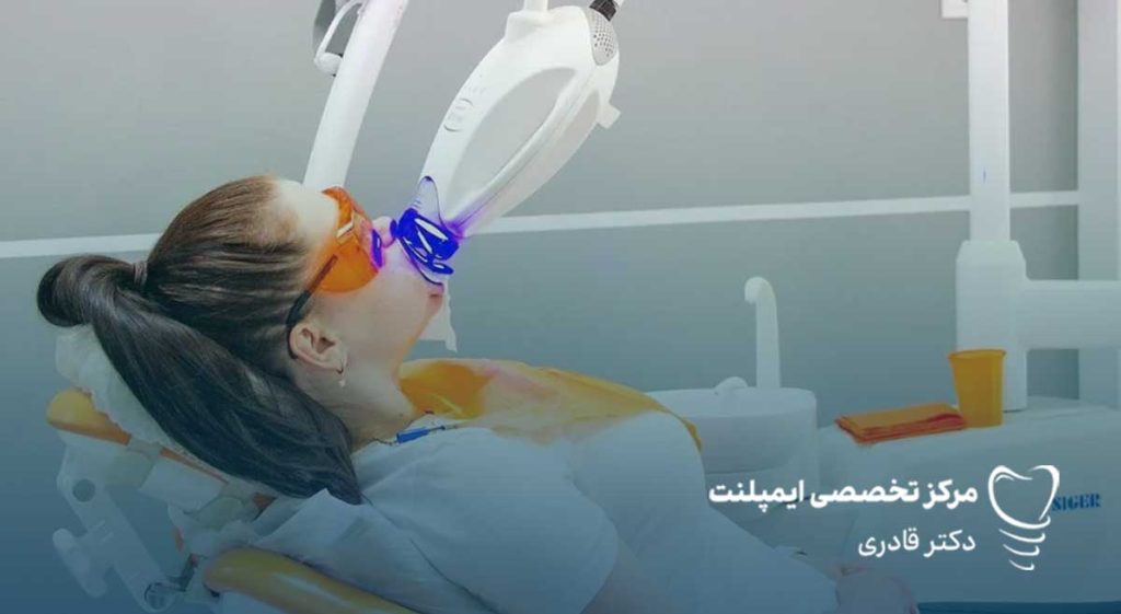 بلیچینگ دندان با لیزر