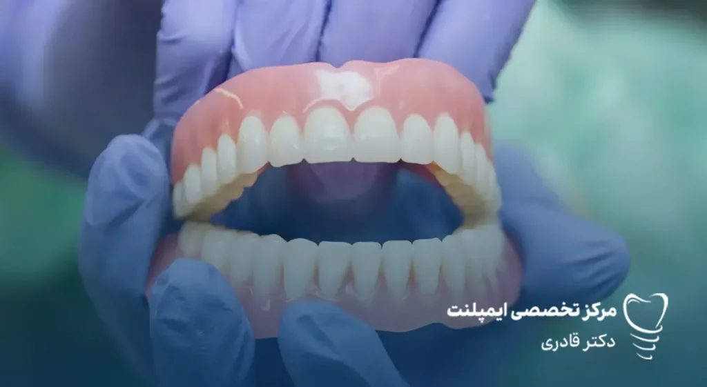 تفاوت دندان مصنوعی با ایمپلنت