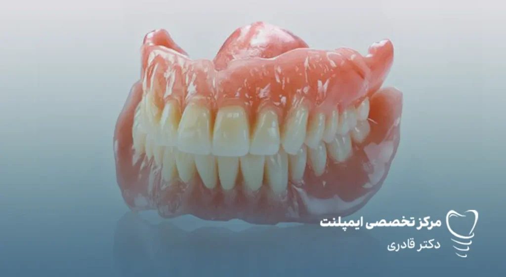 تفاوت دندان مصنوعی با ایمپلنت