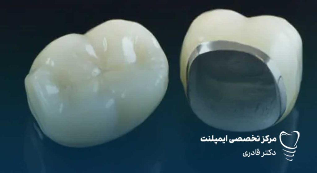 روکش پی اف ام pfm