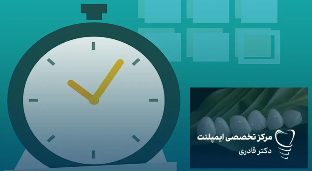 لمینت دندان چقدر طول می‌کشد؟