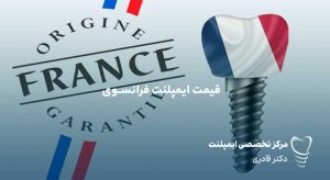 قیمت ایمپلنت فرانسوی