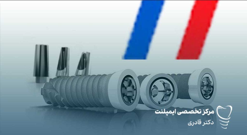 قیمت ایمپلنت فرانسوی
