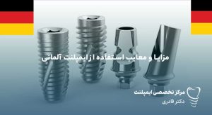 مزایا و معایب استفاده از ایمپلنت آلمانی