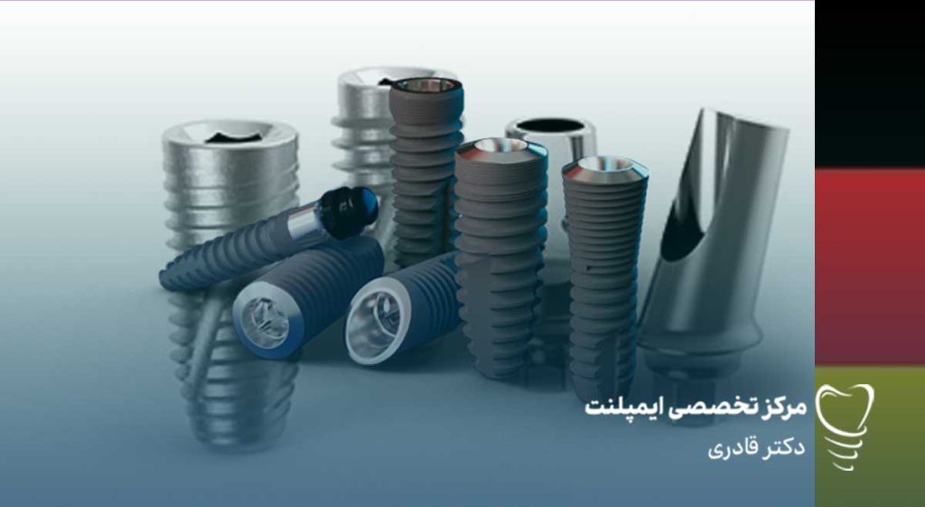 مزایای ایمپلنت المانی1