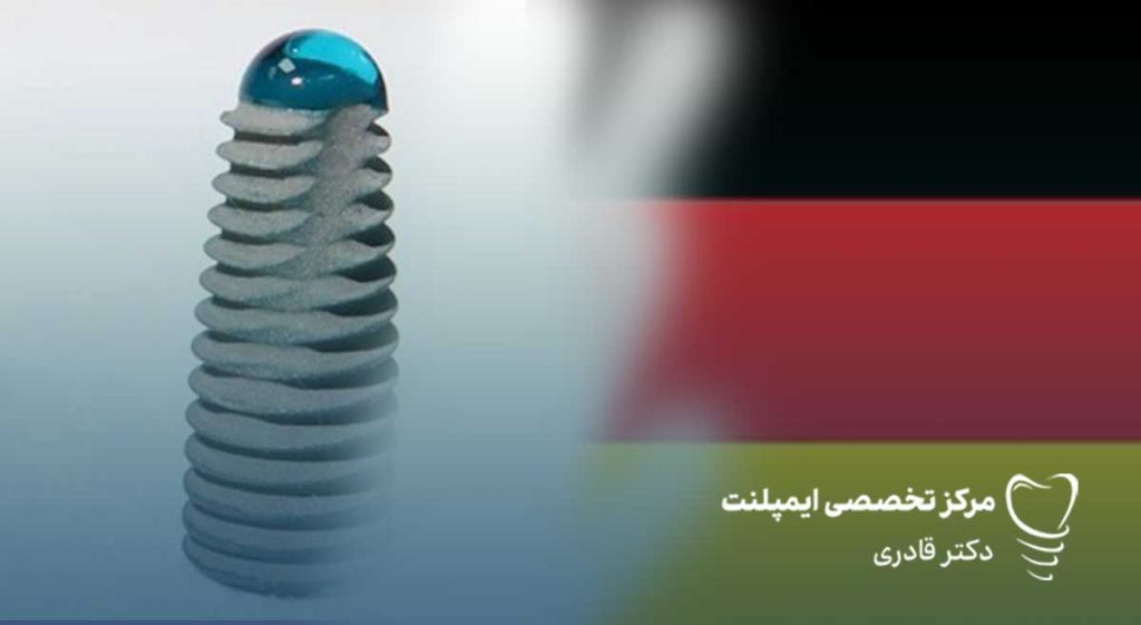 مزایای ایمپلنت المانی2