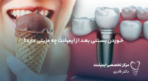 خوردن بستنی بعد از ایمپلنت