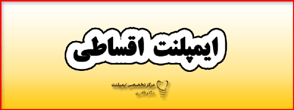 ایمپلنت اقساطی گیف 1