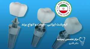 قیمت ایمپلنت ایرای