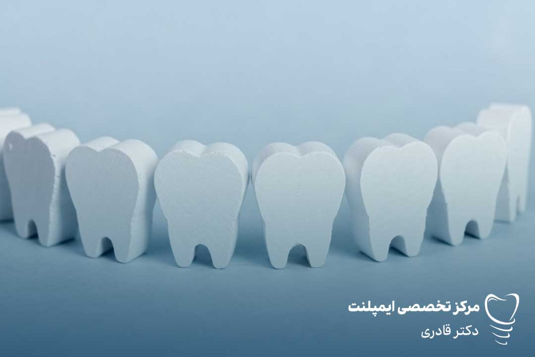 شماره دندان ها - شماره گذاری دندان ها