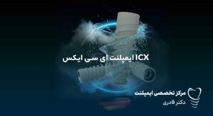 ایمپلنت ای سی ایکس ICX