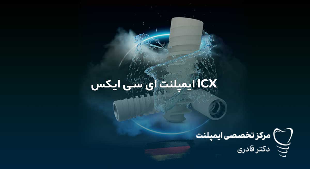 ایمپلنت ای سی ایکس ICX