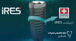 ایمپلنت IRES ایرس
