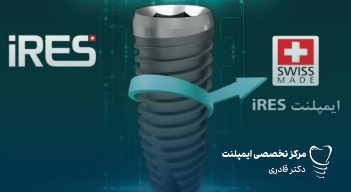 ایمپلنت IRES ایرس
