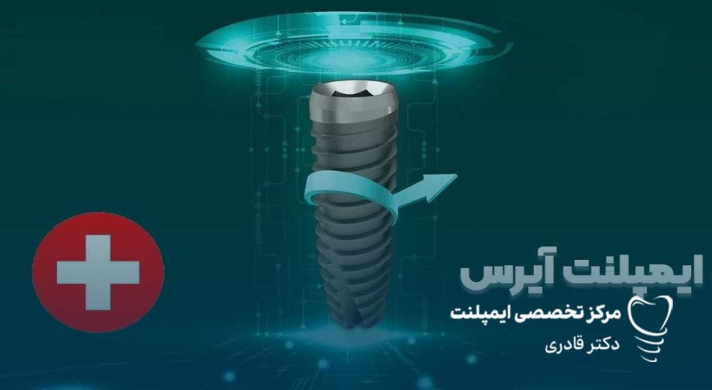 ایمپلنت IRES ایرس