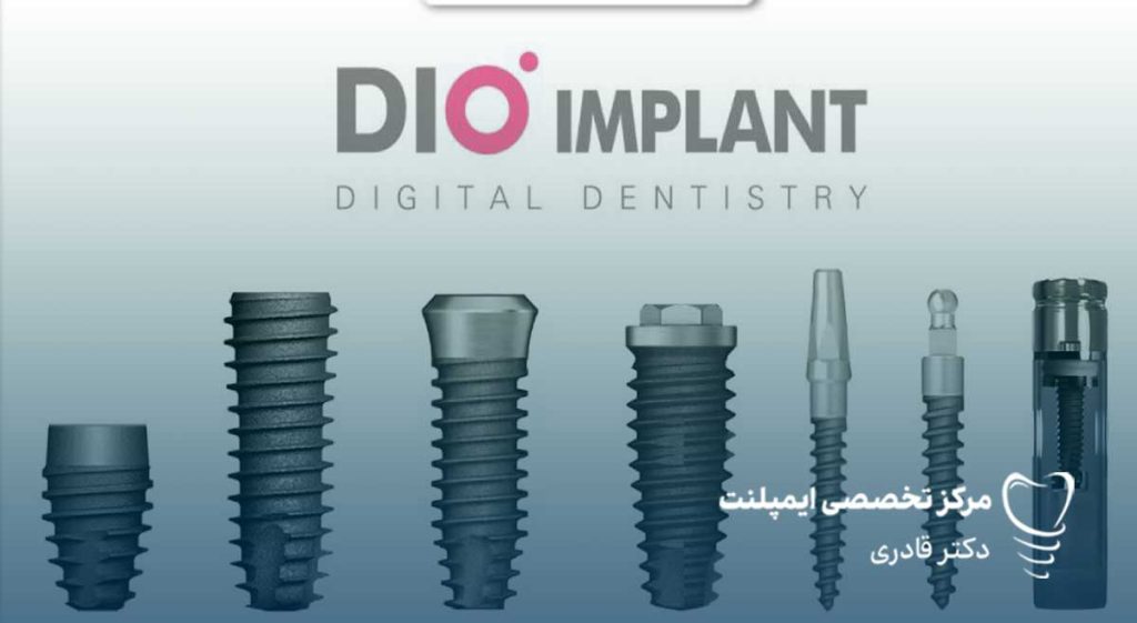 ایمپلنت دی او Dio