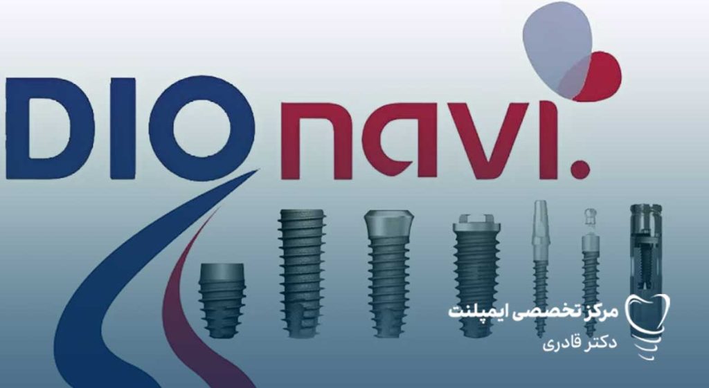 ایمپلنت دیو نوی برند کره ای