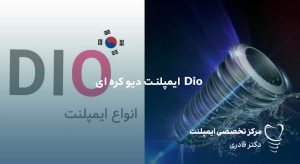 مقالات 29 ایمپلنت Dio دیو کره ای