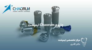 مقالات 31 ایمپلنت Chaorum چاروم