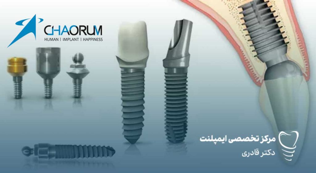 ایمپلنت Chaorum چاروم