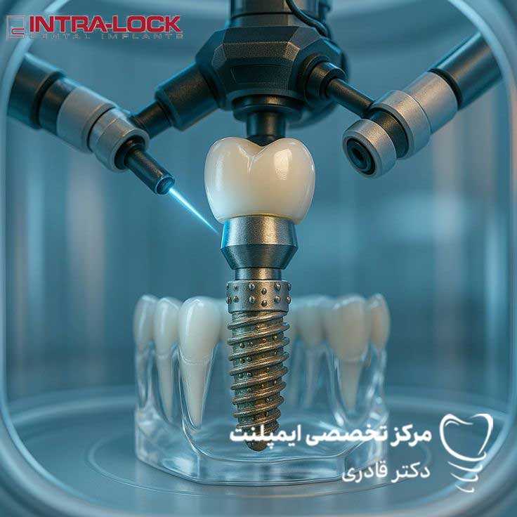 اینترالاک295