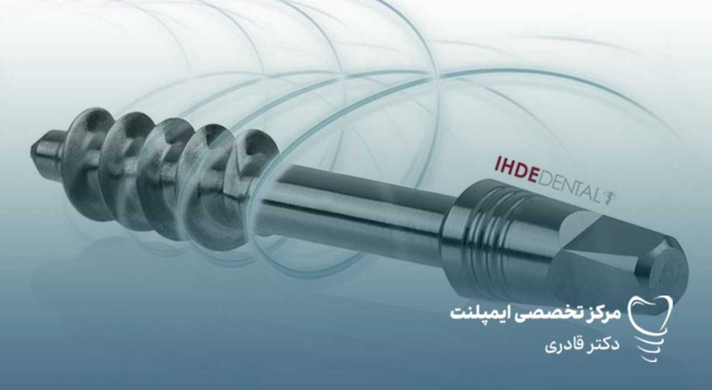ایمپلنت دکتر ایده IHDE