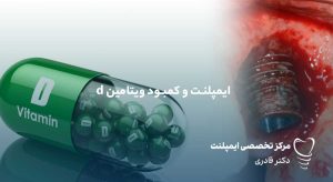 مقالات 33 کمبود ویتامین D و کلسیم