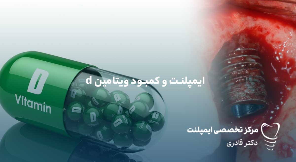 کمبود ویتامین D و کلسیم