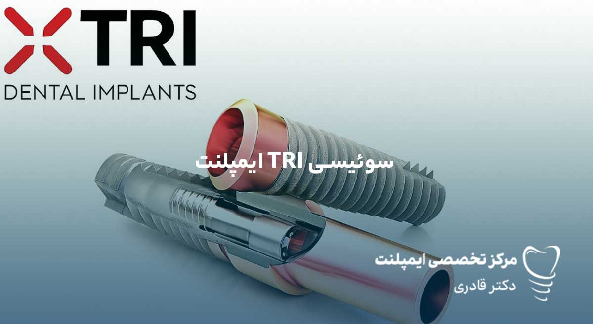 قیمت ایمپلنت TRI سوئیسی